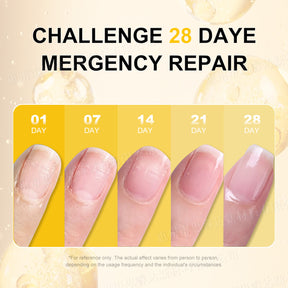 Cross-Border Double-Layer Nail Edge Oil Nail Care Oil Anti-Hangnail Care Solution Cuticle Remover Edge Nail Nutrition Oil Wholesale